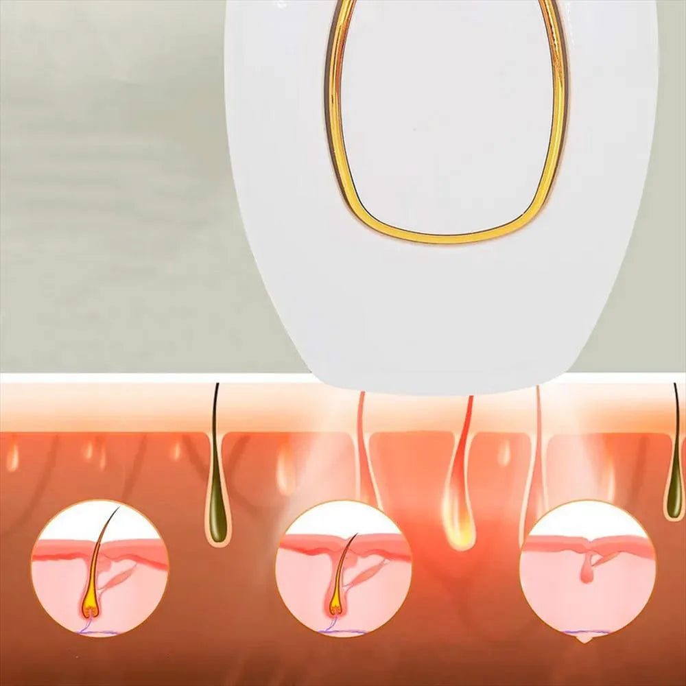 Dispositivo IPL | Depilador Laser Domestico